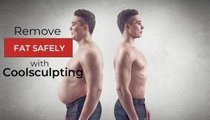 fat freezing non invasive fat removal