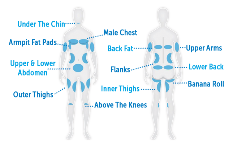 Coolsculpting