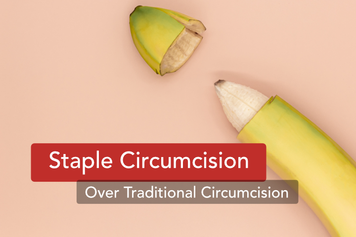 Staple Circumcision Over Traditional Circumcision
