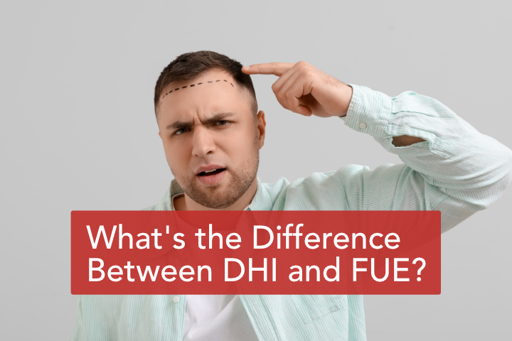 difference between dhi and fue