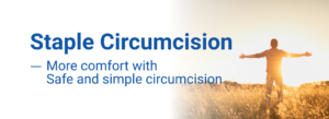 mecb staple circumcision